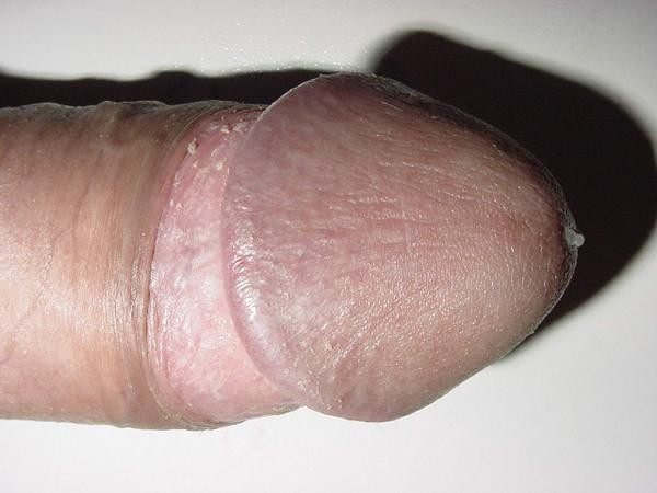 exhiboy03.jpg