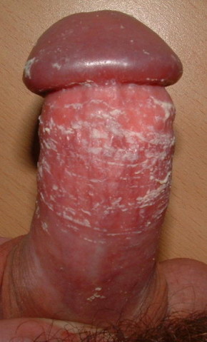 fromtonboy03.jpg