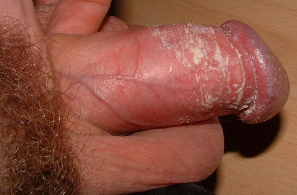 fromtonboy05.jpg
