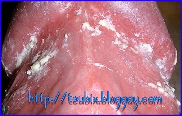 teubix01.jpg