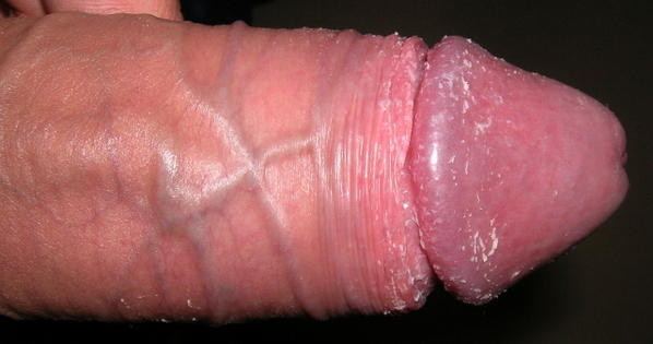 teubix05.jpg