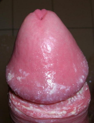 teubix06.jpg