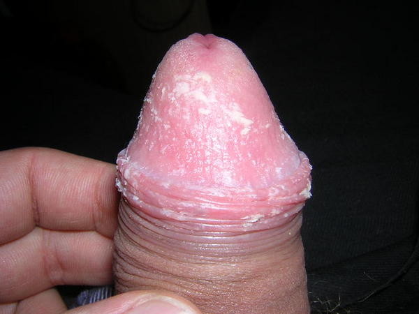 teubix10.jpg