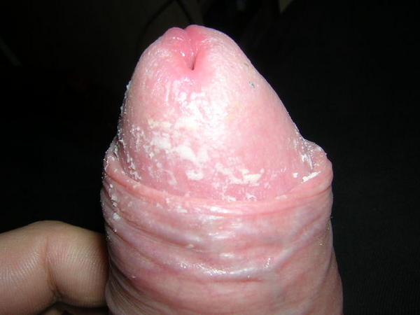 teubix11.jpg