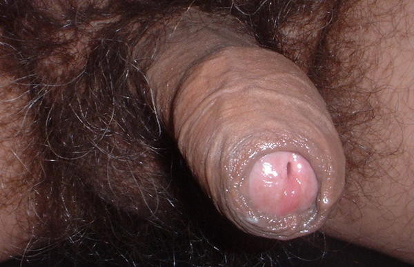 fromton35.jpg