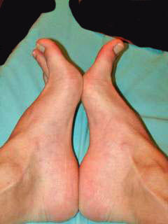 aabb.mespieds-.jpg