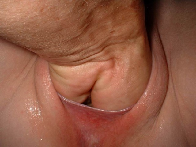 fist-vag1-002.jpg