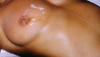 seins-1.jpg