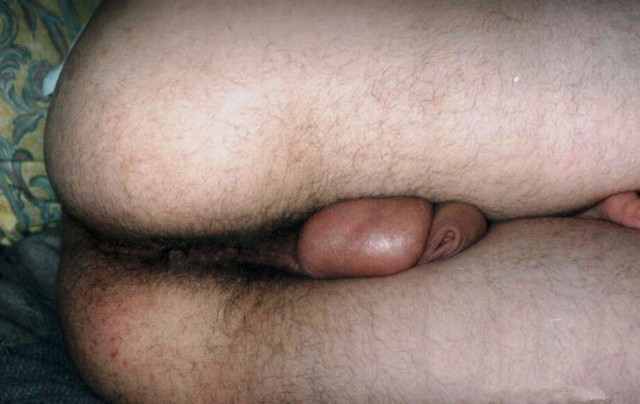 versog1