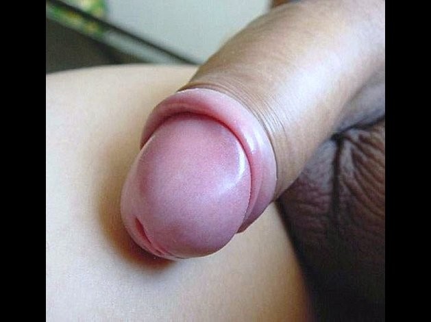 bite (26)