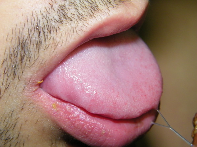 soumis-alex--17-.jpg