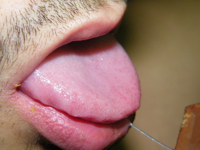 soumis-alex--18-.jpg