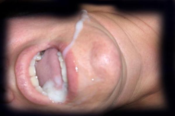 sperme--2-.JPG