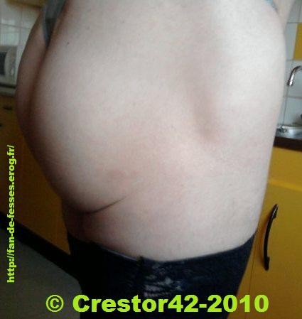 Crestor42 (3)