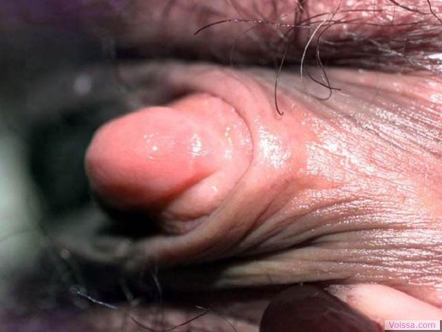 med gallery 175262 136292 3348