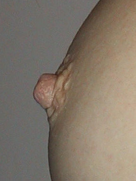 Female nipple profile
