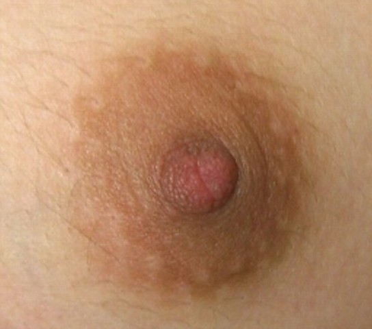 Nipple