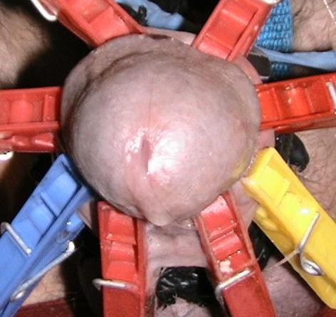 étoile pincée