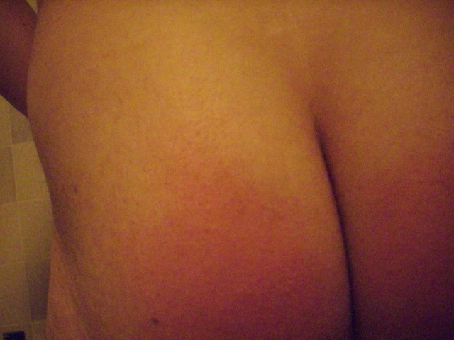 les fesses apres les 40 coups