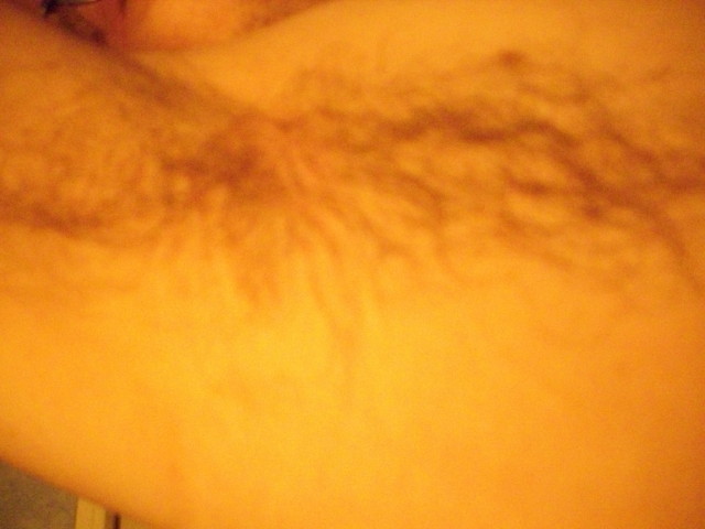dessous de bras avant rasage 2