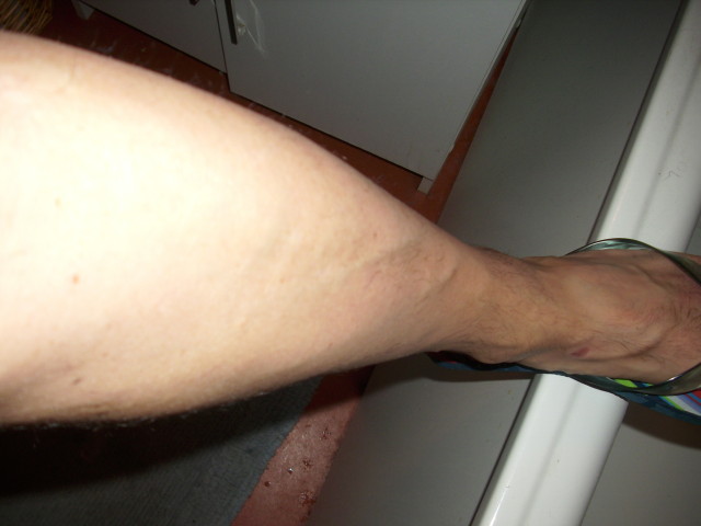 jambe apres rasage