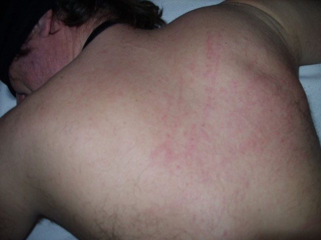 K00305