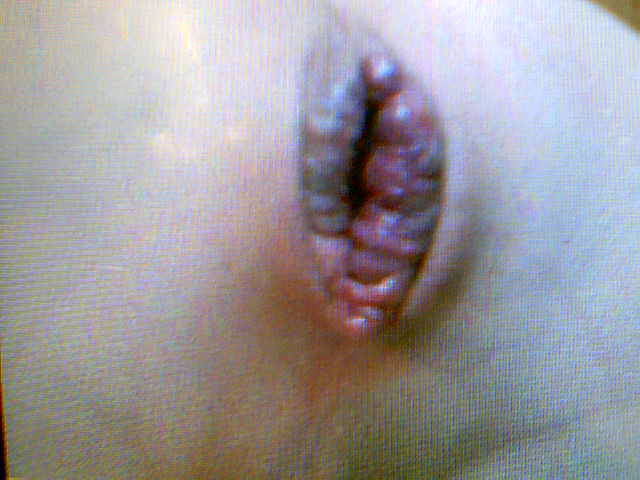 2010-03-05-35737