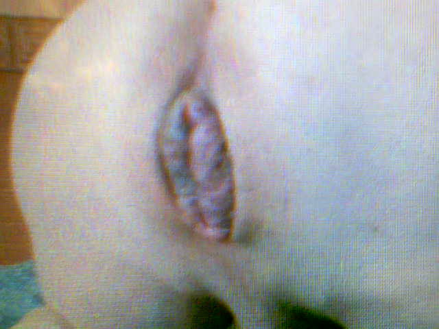 2010-03-05-35785
