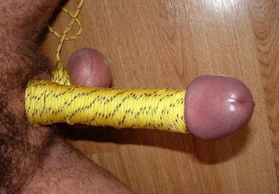 tortura_genital9.jpg