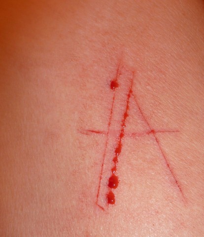 scarification 003