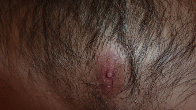 P1040987
