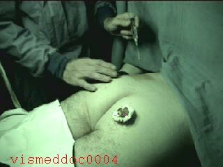 Cnv0007