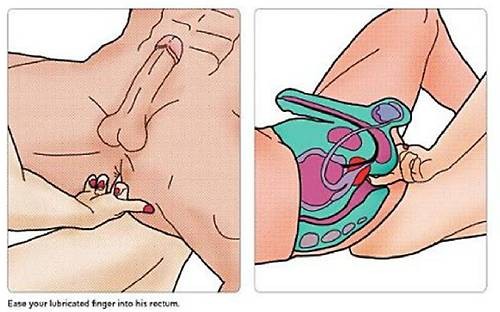 stimulation prostate etape 3 (2)