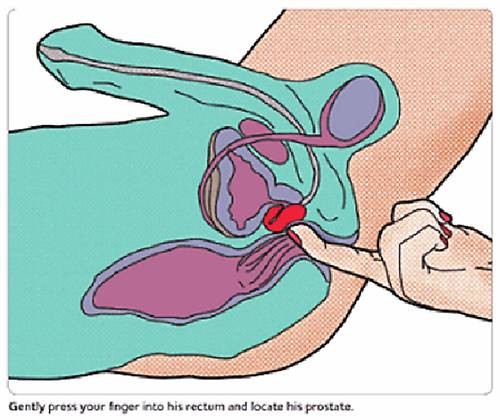 stimulation prostate etape 5jpg