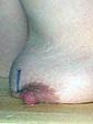 Aiguilles dans les seins2 (122)