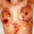 Travail des seins11 (41)