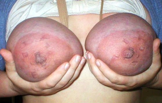 Travail des seins5 (296)