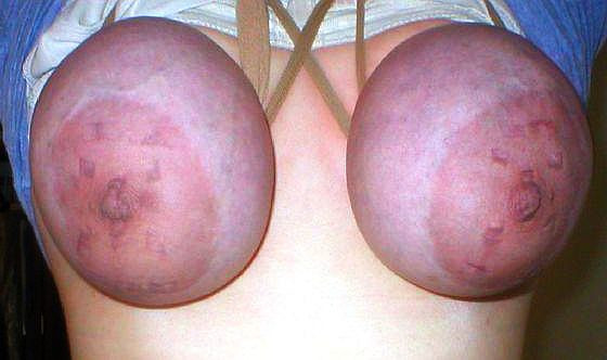 Travail des seins5 (326)