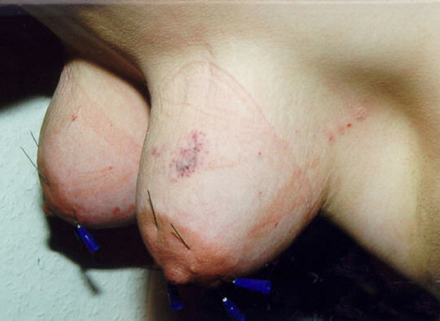 Travail des seins7 (151)