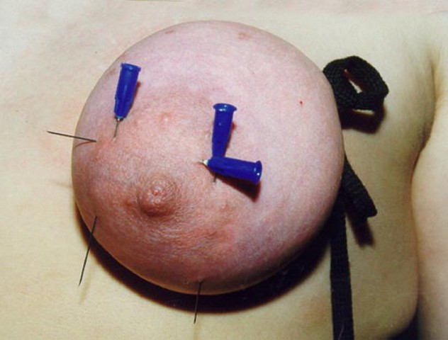Travail des seins7 (191)