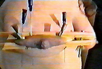 Travail des seins7 (21)