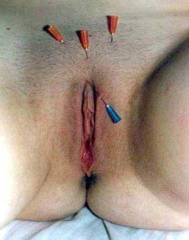 10 (22)