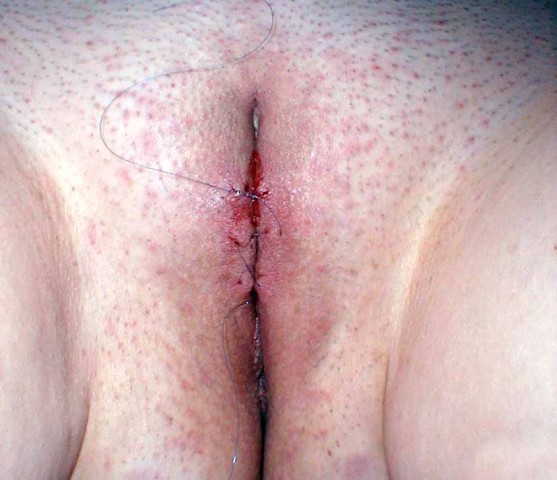 Clito gros plan (111)