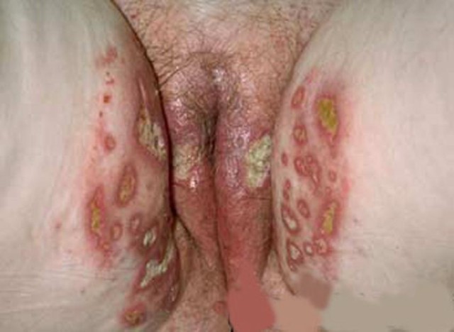 Clito gros plan (35)