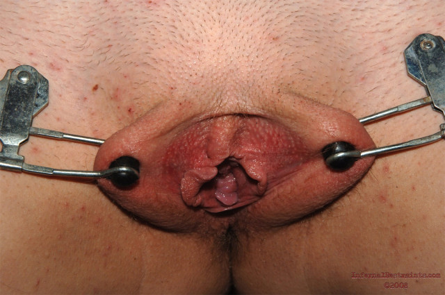 1 (102)