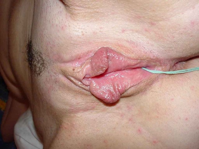 2 (49)