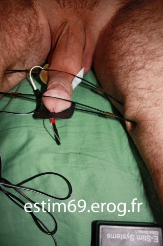e-stim3