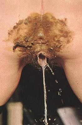 shitty+hole+8