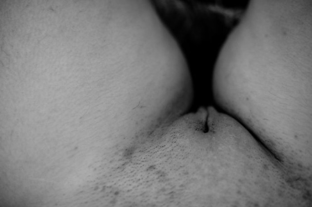 034
