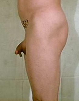 clito  de  lopette